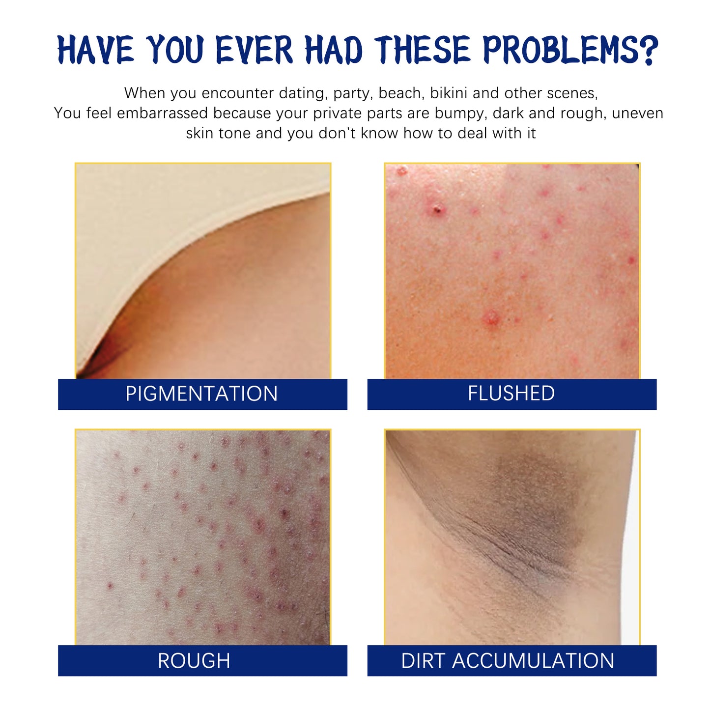 Body Whitening Cream, Lightening Dull Skin Even Skin Tone Moisturizing Skin Beauty Cream by eprolo