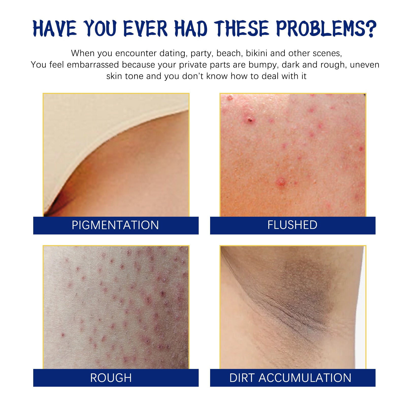 Body Whitening Cream, Lightening Dull Skin Even Skin Tone Moisturizing Skin Beauty Cream by eprolo