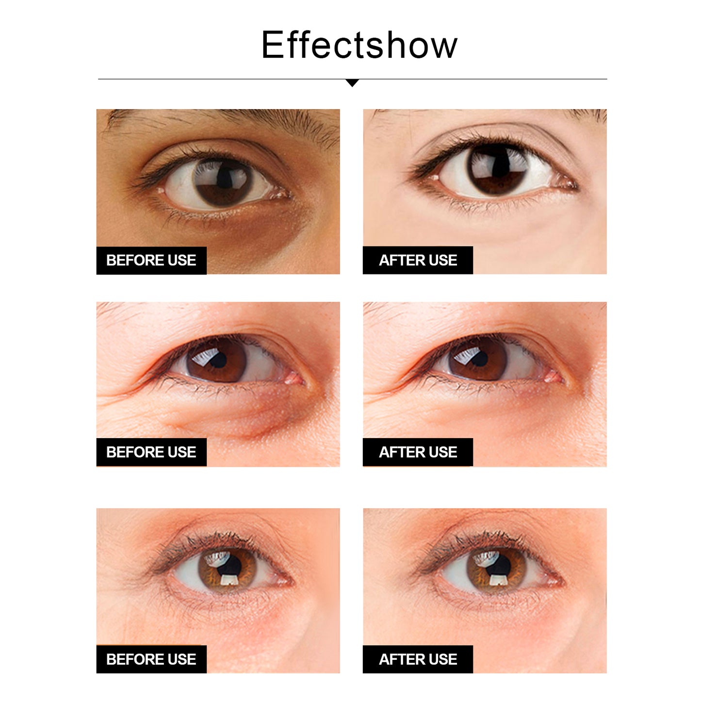 Snake Venom Eye Cream, Firming Eye Bags Hydrating And Reducing Fine Lines Eye Care Eye Cream by eprolo