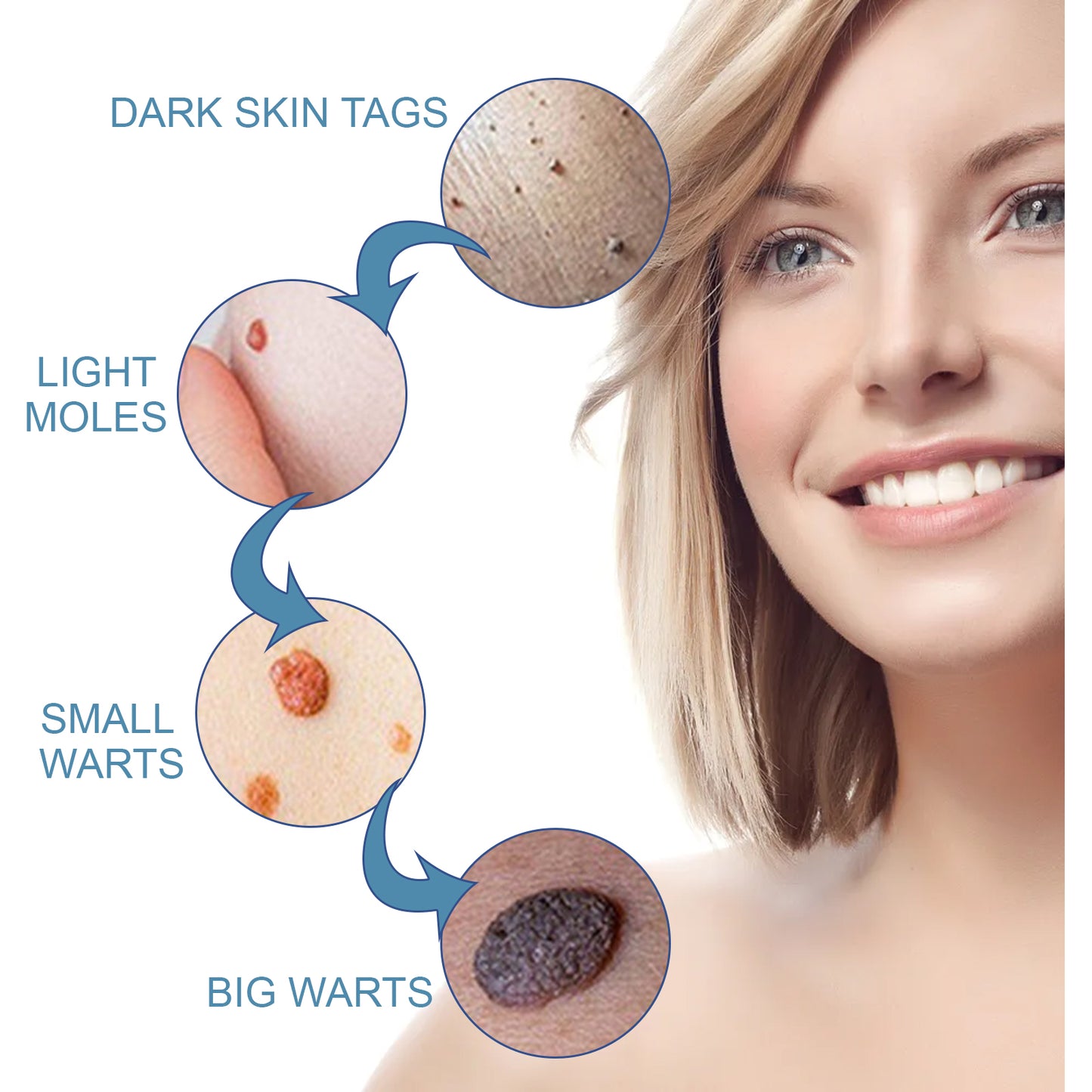 Wart Cream, Skin Clean And Smooth Wart Nevi Facial Care Cream by eprolo