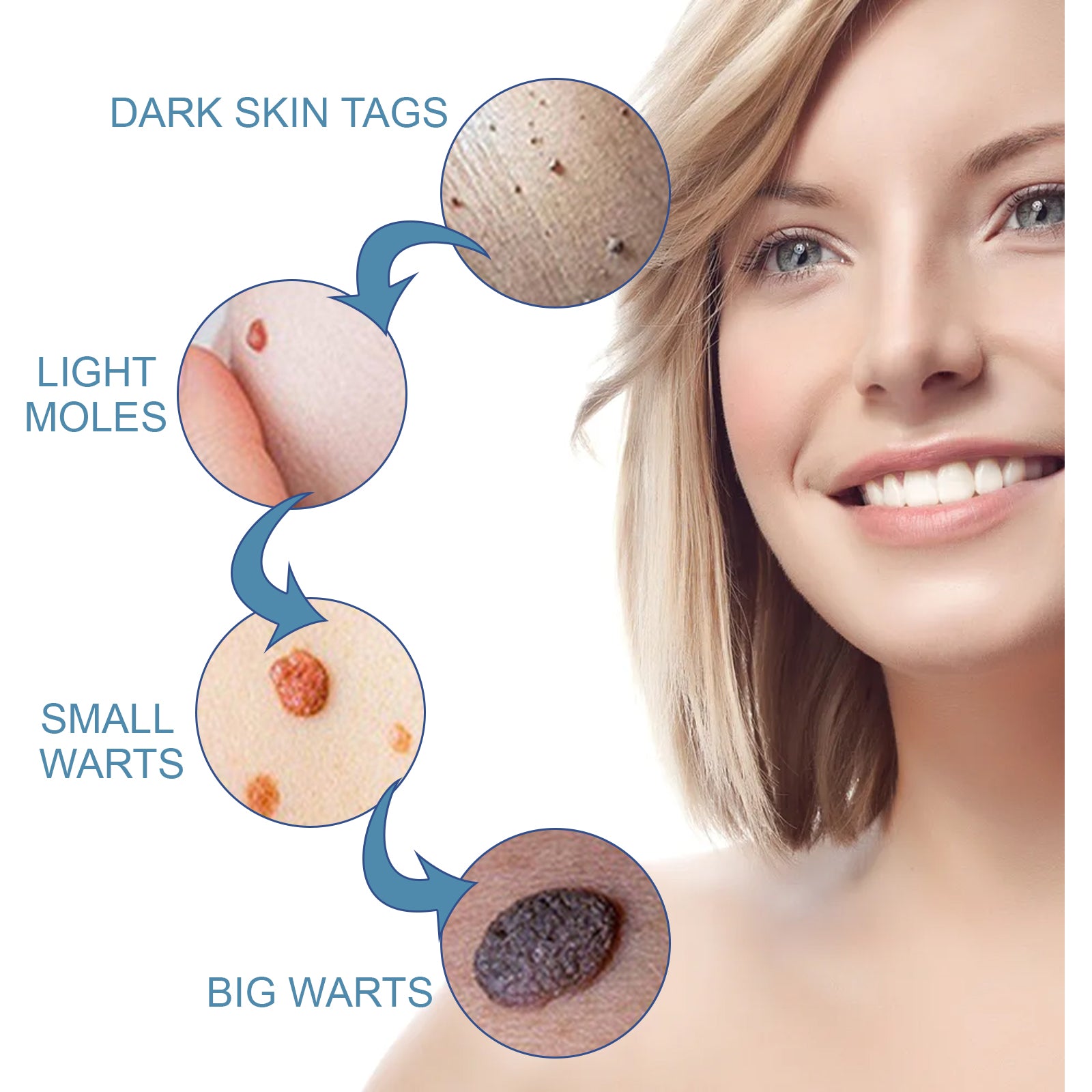 Wart Cream, Skin Clean And Smooth Wart Nevi Facial Care Cream by eprolo