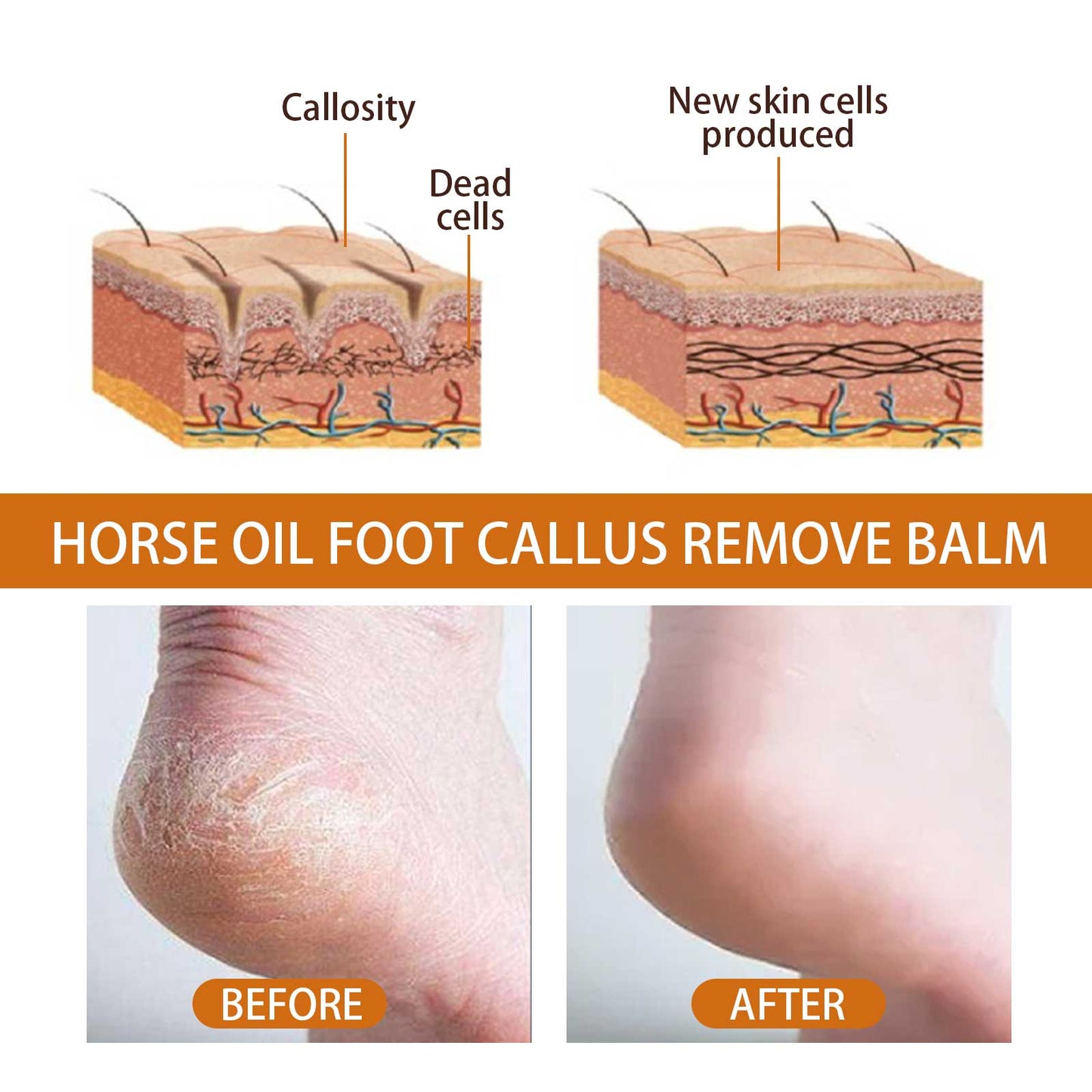 Horse Oil Foot Care Cream, Repair Heel Peeling Anti-Cracking Moisturizing Foot Care Cream by eprolo