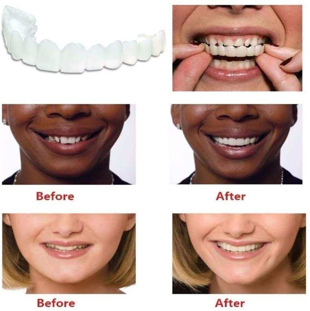 Upper Teeth And Lower Teeth Simulation Braces Non-Porous Braces Whitening Sleeves Second-Generation Silicone Simulation Teeth Dentures by eprolo