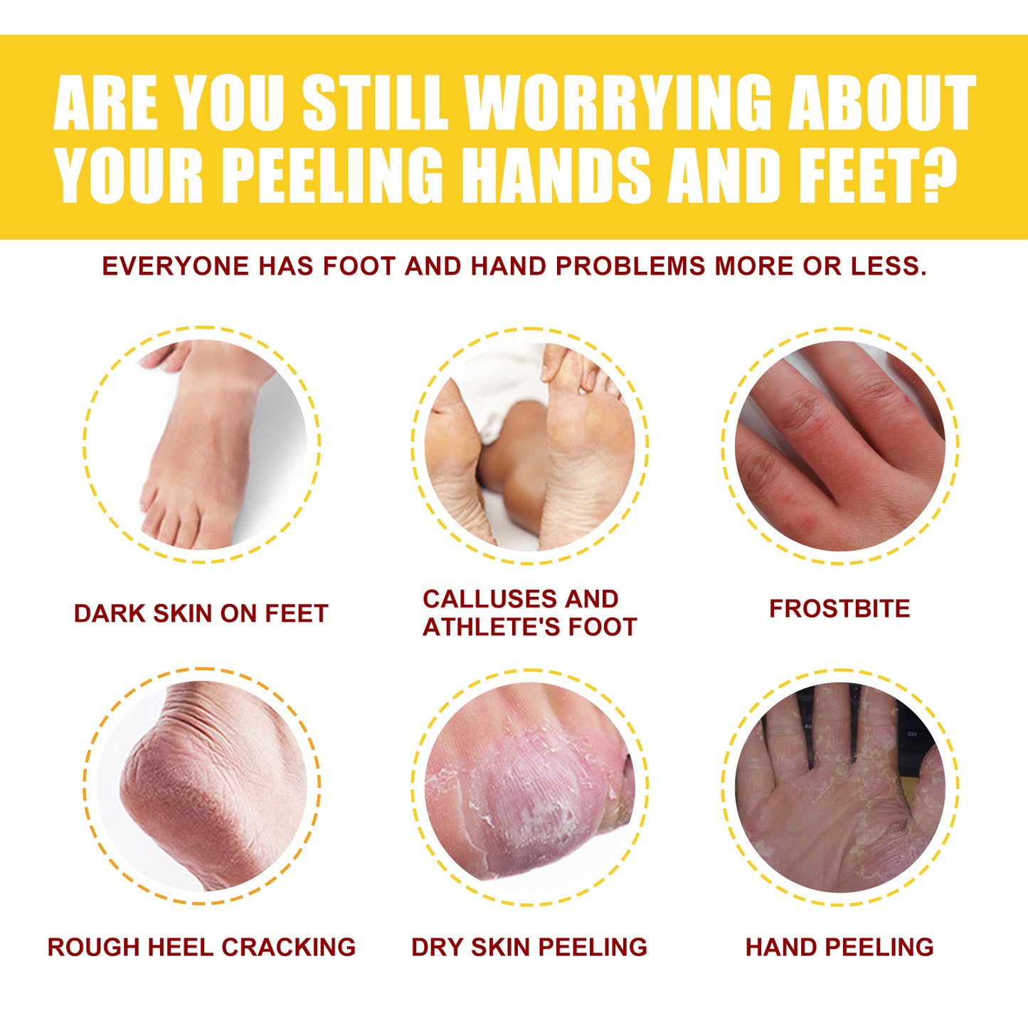 Horse Oil Hand And Foot Repair Cream, Chapped Skin Care Moisturizing And Anti-Peeling Repair Cream by eprolo