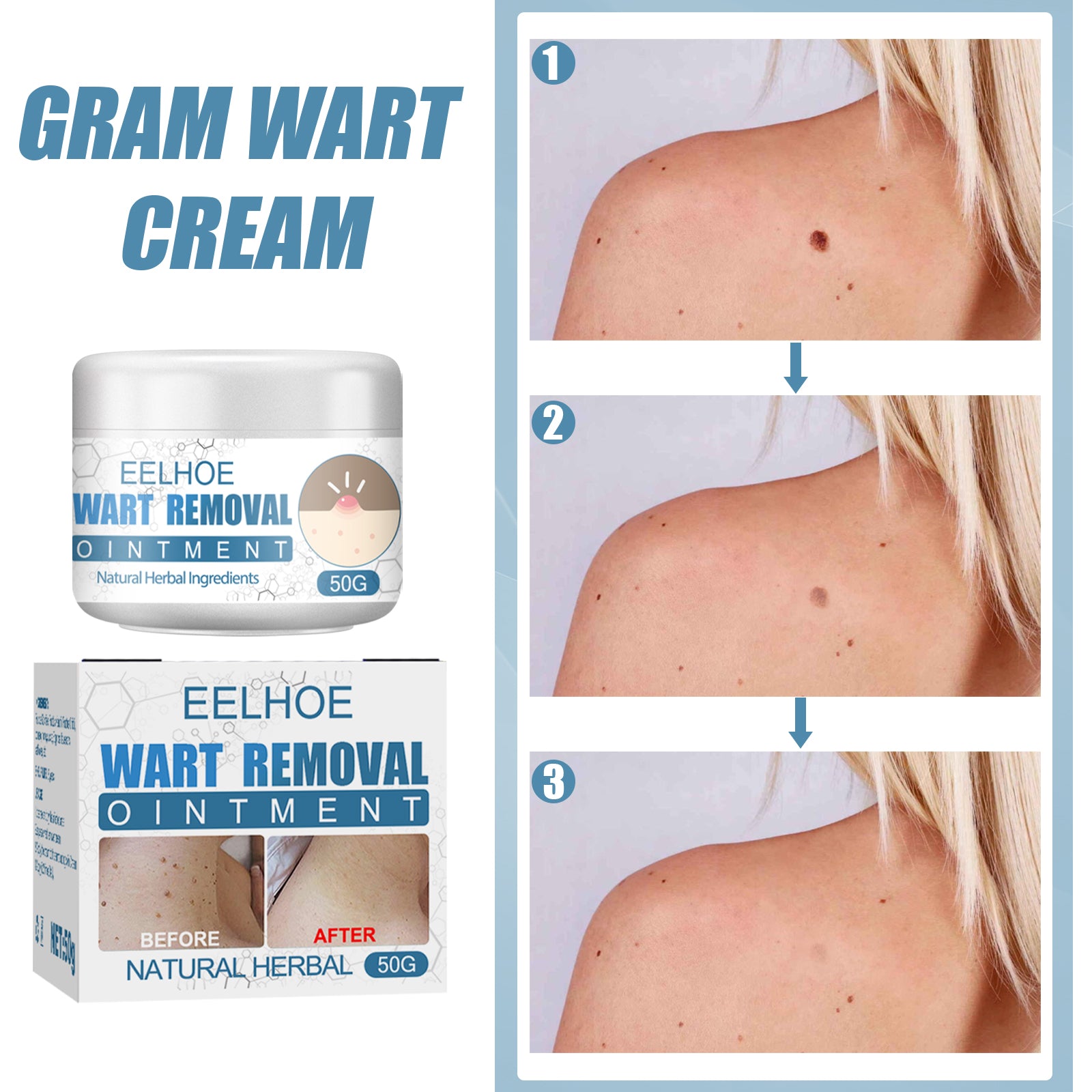 Wart Cream, Skin Clean And Smooth Wart Nevi Facial Care Cream by eprolo