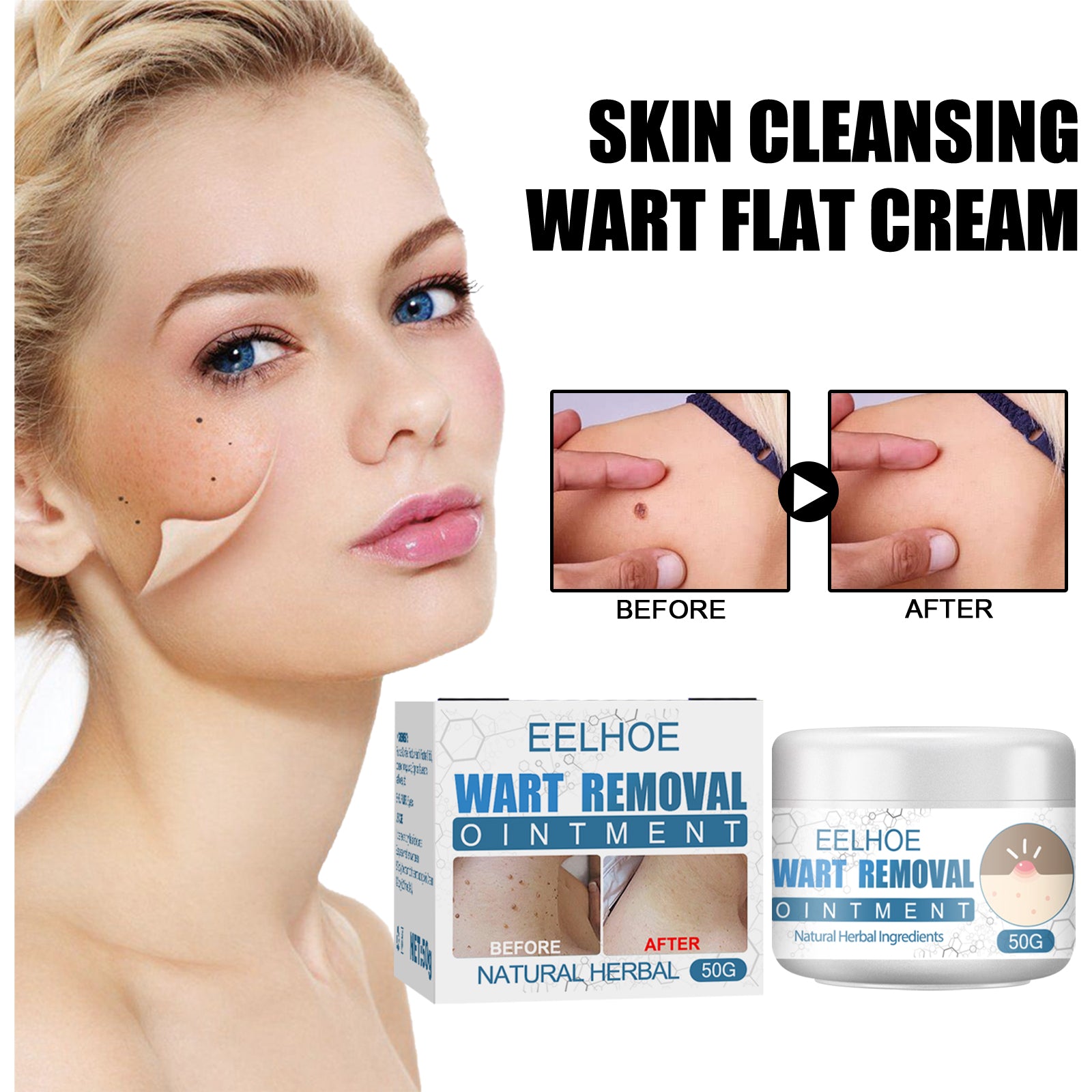 Wart Cream, Skin Clean And Smooth Wart Nevi Facial Care Cream by eprolo