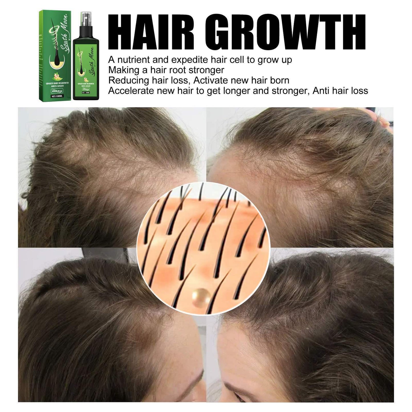 South Moon Hair Care Spray Hair Nourishing Massage Repair Hair Care Scalp Treatment Solution